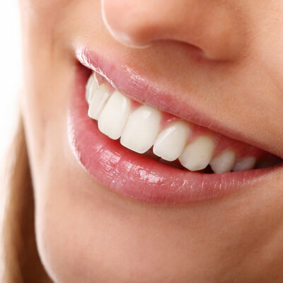 6 Popular Teeth Whitening Procedures