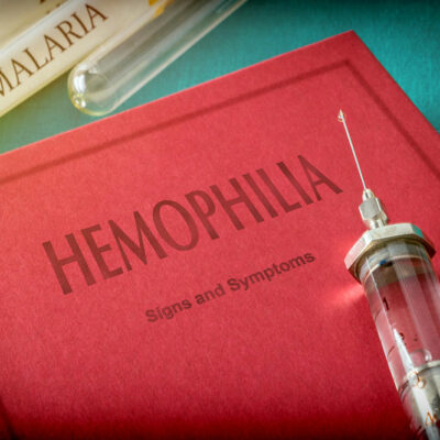 6 Healthy Lifestyle Tips for Hemophilia