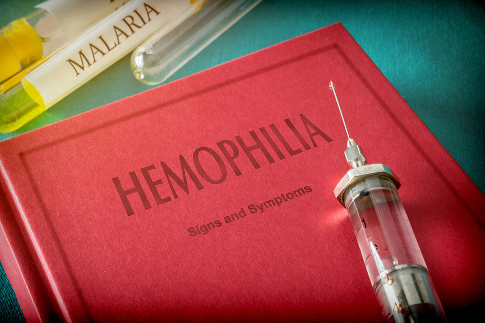 6 Healthy Lifestyle Tips for Hemophilia