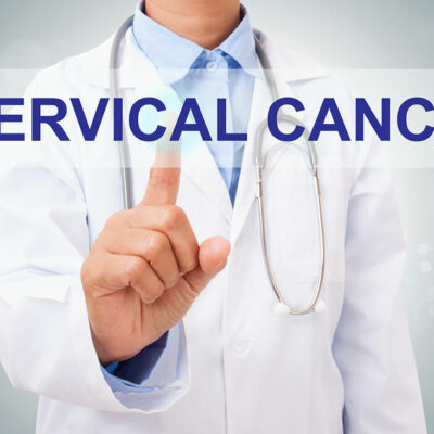 8 Risk Factors for Cervical Cancer