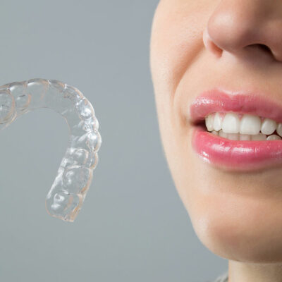 Clear Aligners vs. Traditional Braces – Which is Better?
