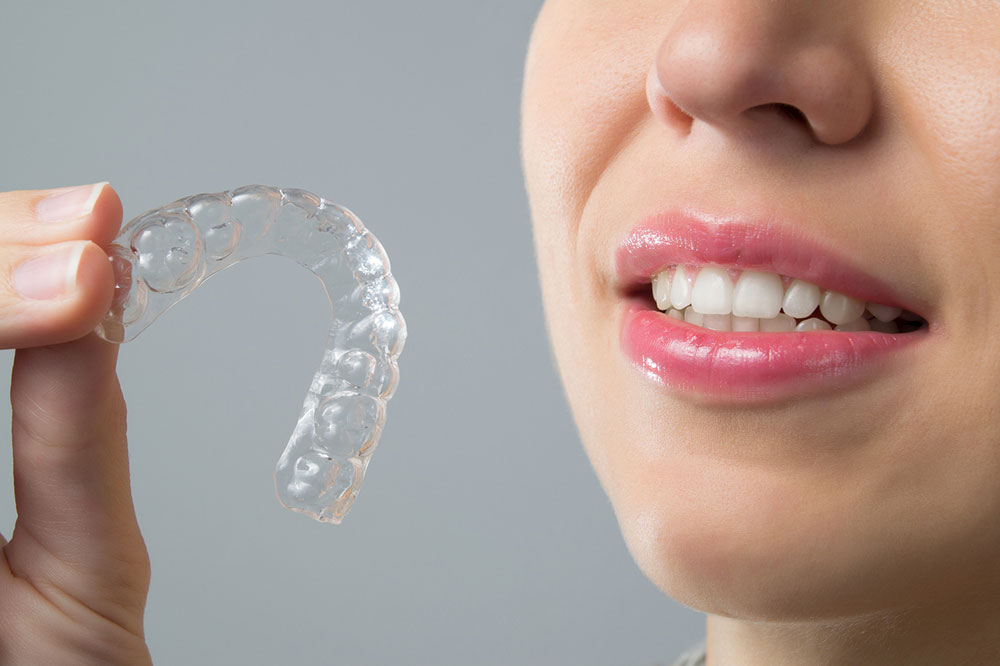 Clear Aligners vs. Traditional Braces – Which is Better?